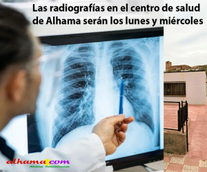 Las radiografías en el centro de salud de Alhama serán los lunes y miércoles